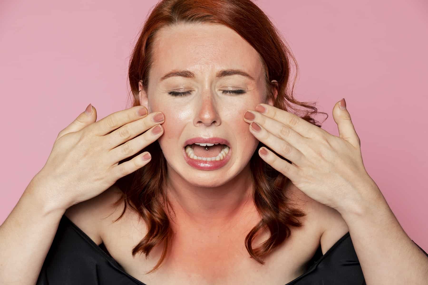 Плачеща жена със слънчево изгаряне на лицето
